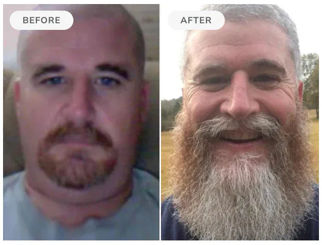 Before and after, 90 days of Beard Boost