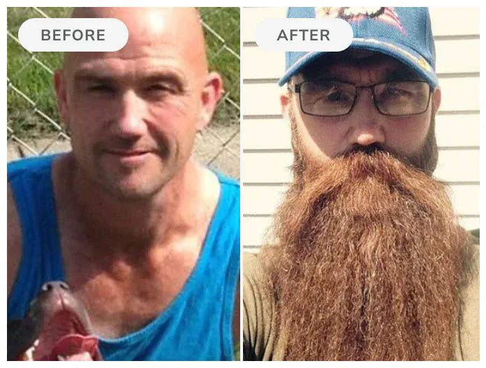 Before and after, 90 days of Beard Boost