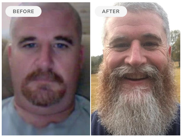 Before and after, 90 days of Beard Boost