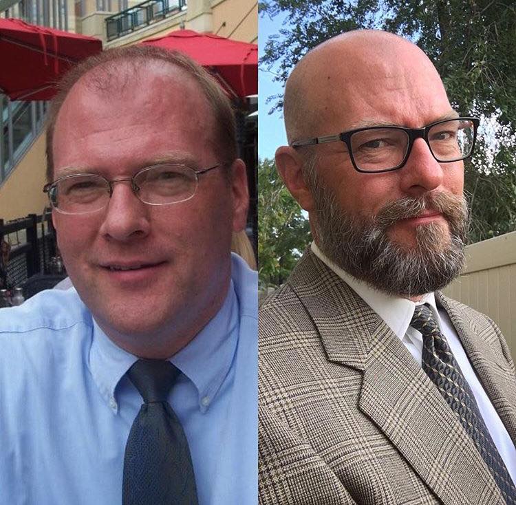 Before and after — 3 months on Beard Boost
