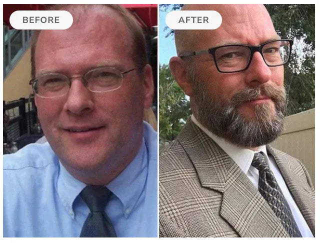 Before and after, 90 days of Beard Boost