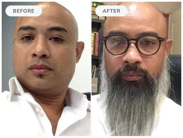Before and after, 90 days of Beard Boost