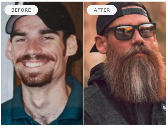 Before and after, 90 days of Beard Boost