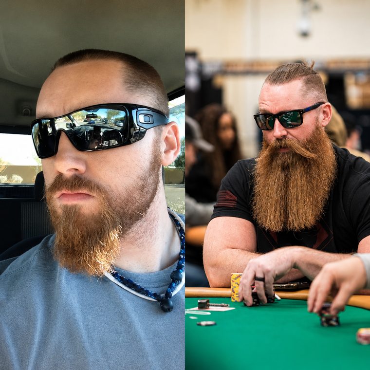 Before and after — 1 year on Beard Boost