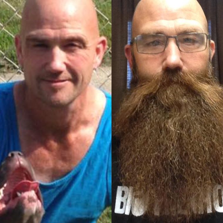 Before and after — 1 year on Beard Boost