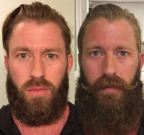 Before and after — 3 months on Beard Boost