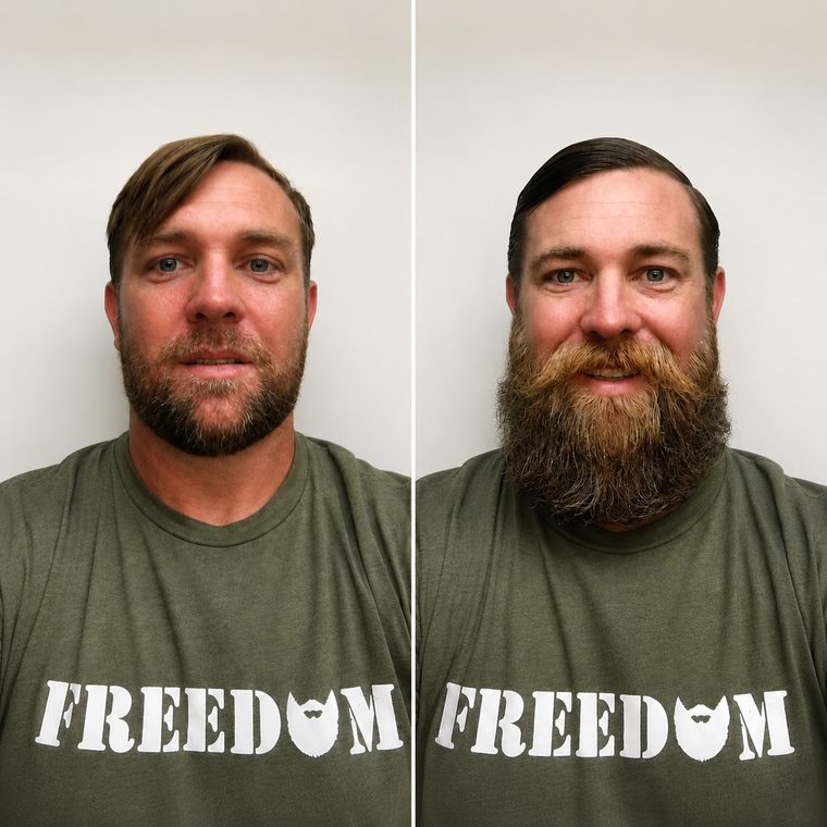 Before and after — 5 months on Beard Boost