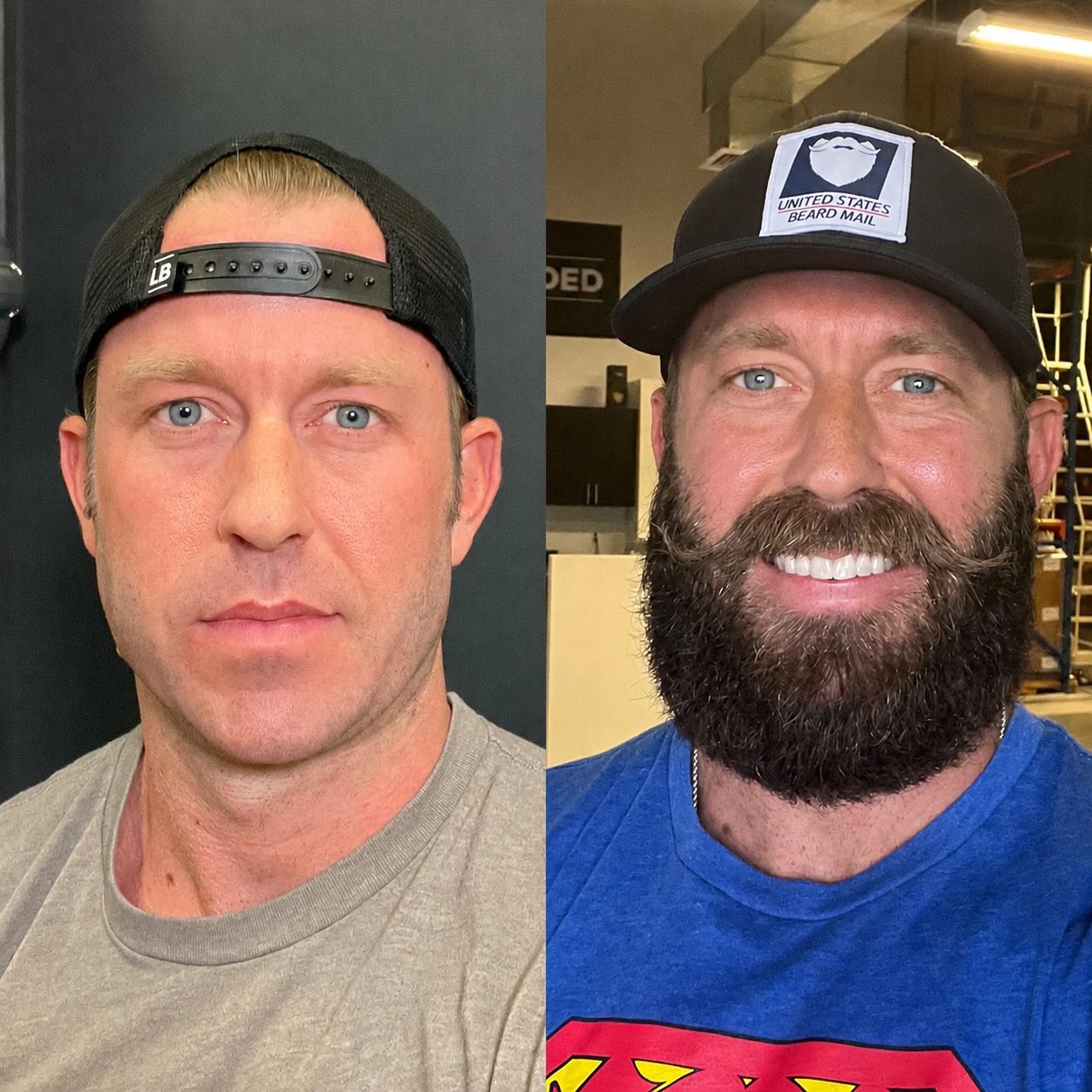 Before and after: 100 days of beard growth on Beard Boost